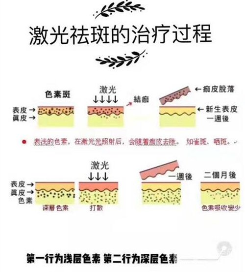 天津醫(yī)科大學(xué)腫瘤醫(yī)院整形科價格表，附激光祛斑恢復(fù)*果圖