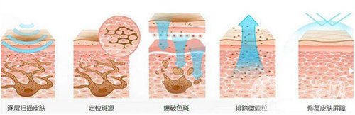天津醫(yī)科大學(xué)腫瘤醫(yī)院整形科價格表，附激光祛斑恢復(fù)*果圖