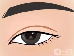 割雙眼皮適合與不適合的人群有哪些？