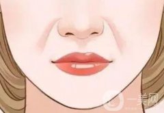 形成法令紋的原因是什么？