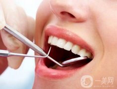 洗牙能美白牙齒嗎？洗牙對(duì)牙齒有害嗎？