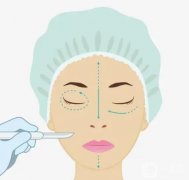 隆鼻后要忌口多久？哪些不能吃？