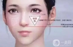 填充蘋果肌有哪些方法？