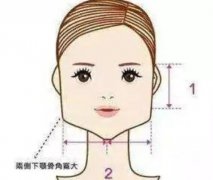 下頜角截骨術(shù)完全恢復(fù)需要多長時(shí)間？