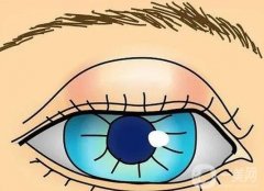 眼皮抽脂后怎么護(hù)理？