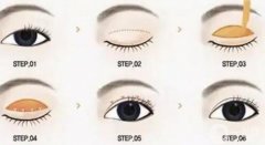 雙眼皮手術(shù)恢復(fù)需要多長(zhǎng)時(shí)間？