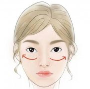 填充蘋果肌的價(jià)格是多少？