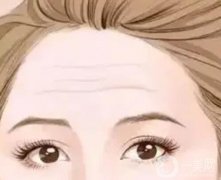 有抬頭紋的原因是什么？可以去掉嗎？