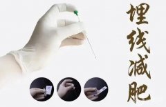 埋線減肥的風(fēng)險有哪些？