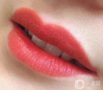 自體脂肪豐唇一般需要多少錢？