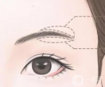切眉手術(shù)后會(huì)很快衰老嗎