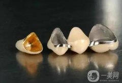 烤瓷牙的壽命怎么延長?烤瓷牙的注意事項？