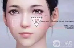 填充蘋果肌有什么方法？