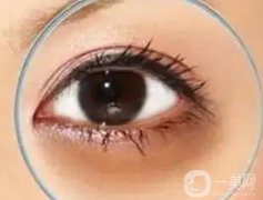 用激光去除黑眼圈后怎么護(hù)理？
