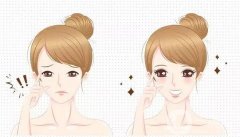 雙眼皮可以做第二次嗎？