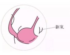 副乳切除后吃什么水果好？