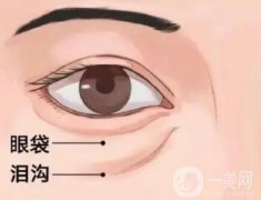 去眼袋手術(shù)適合什么季節(jié)做？