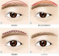 切眉后留疤了怎么辦？有哪些應(yīng)該注意？
