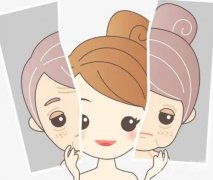彩光嫩膚有什么果？對皮膚有什么傷害嗎？