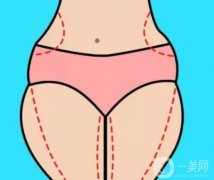 抽脂沒有瘦的原因是什么？如何控制體重?