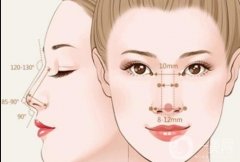 膨體隆鼻后果不理想怎么辦?