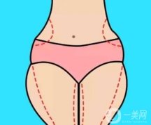 抽脂瘦腿后遺癥有哪些？