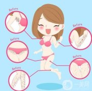 冰點(diǎn)脫毛的優(yōu)勢(shì)有哪些？