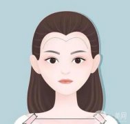 有多少植發(fā)的方式？毛發(fā)移植的步驟有哪些呢？