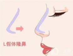 為什么L型硅膠假體會滑落？