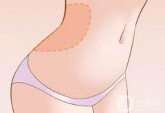 全身吸脂手術(shù)不適合哪些人？
