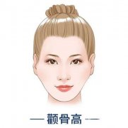 顴骨墊高失敗什么時候可以修復(fù)？