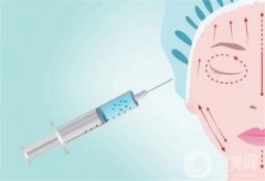 什么因素影響玻尿酸填充淚溝的價(jià)格？