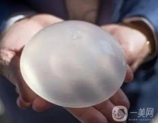妙桃假體有哪些優(yōu)勢？