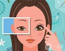 腫眼泡適合做雙眼皮嗎，適合什么樣的雙眼皮
