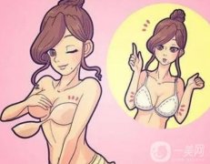 注射豐胸的材料有哪些？