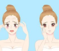 頸部除皺有哪些方法?注意事項？