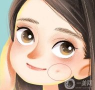 人造酒窩有哪些禁忌癥？