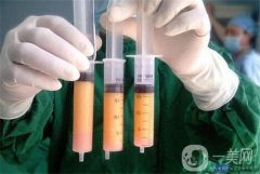 腹部吸脂整形要多少錢？