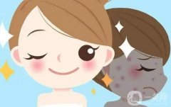 光子嫩膚的性怎么樣？