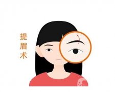 微創(chuàng)提眉術(shù)手術(shù)方法？微創(chuàng)提眉術(shù)的特點(diǎn)？