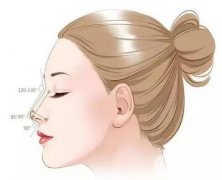 隆鼻術后產(chǎn)生的疤痕增生如何護理？