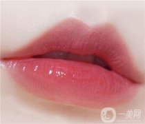 唇珠重建整形的方法？唇珠重建前的注意事項