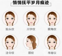 電波拉皮手術(shù)到底好不好？術(shù)后注意事項(xiàng)？