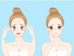 適合與不適合電波拉皮的人？