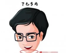 墊下巴后多長(zhǎng)時(shí)間可以正常笑？