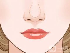 耳軟骨墊鼻尖是不是*性的？