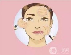 電波拉皮果可以持續(xù)多長(zhǎng)時(shí)間？