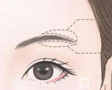 切眉有什么作用和副作用？