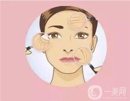 熱瑪吉拉皮除皺多少錢？