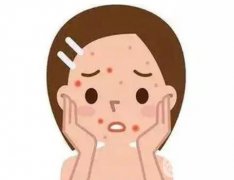 果酸祛痘的原理？果酸的祛痘果好不好？